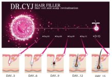 Dr Cyj Filler – terapia wypadania włosów