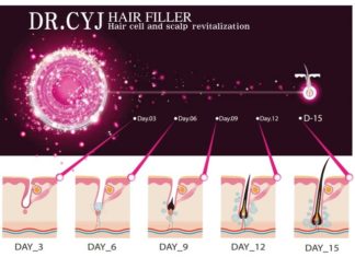 Dr Cyj Filler – terapia wypadania włosów